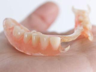 Čiastočne snímateľná náhrada