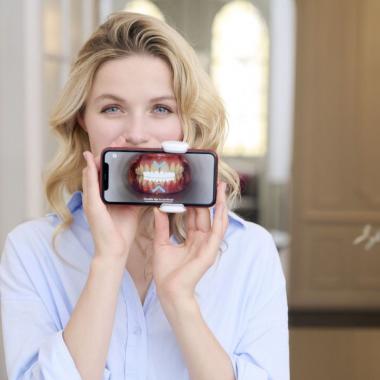 7 výhod dentálneho monitorovania pre pacientov s neviditeľnými aparátmi